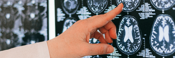 Medical professional examining brain scans.