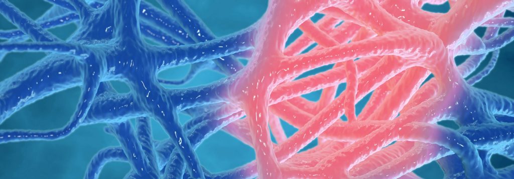 Inflammation is part of the body’s natural defence mechanism.