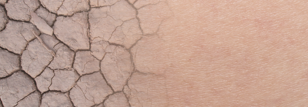 A photo of cracked, sun-baked earth blends into a photo of skin, left to right.