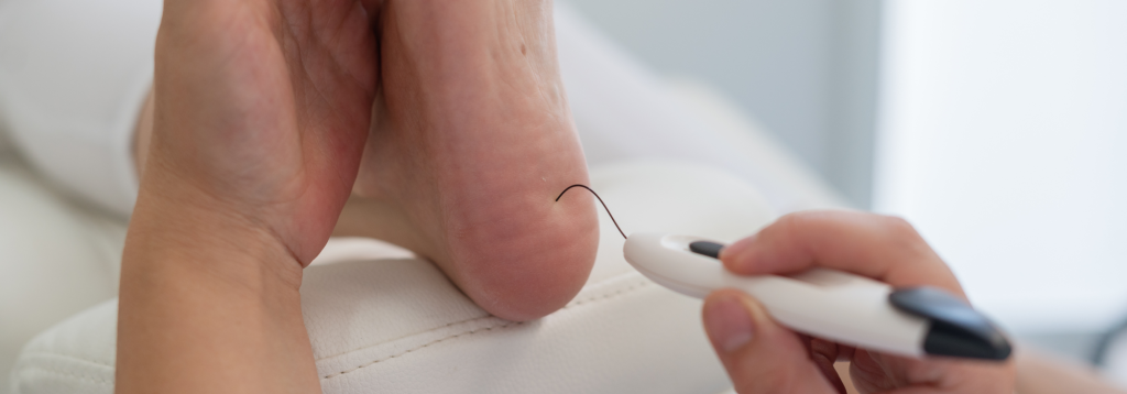 Diabetes and foot health