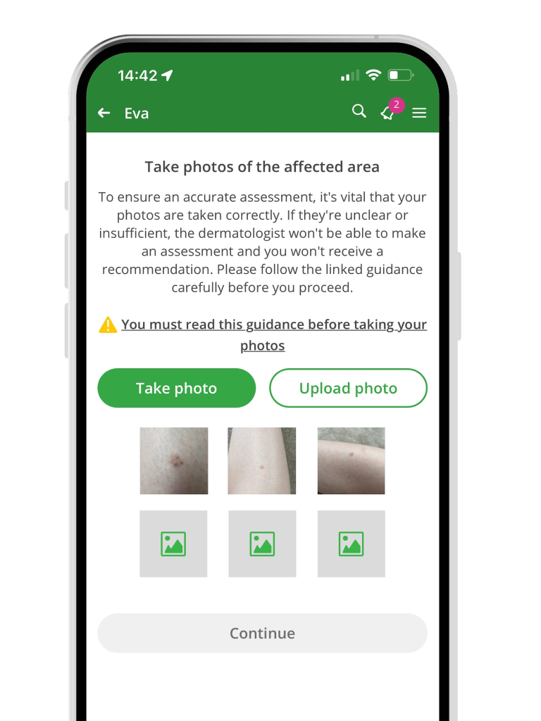 A mock up photo of Evergreen Life's digital Mole Checking Service on a mobile phone.