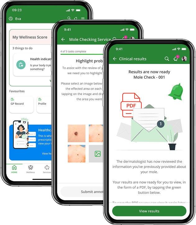 A collection of smart phone images displaying the ui of the mole checker application.